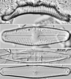 Diatoms under microscope